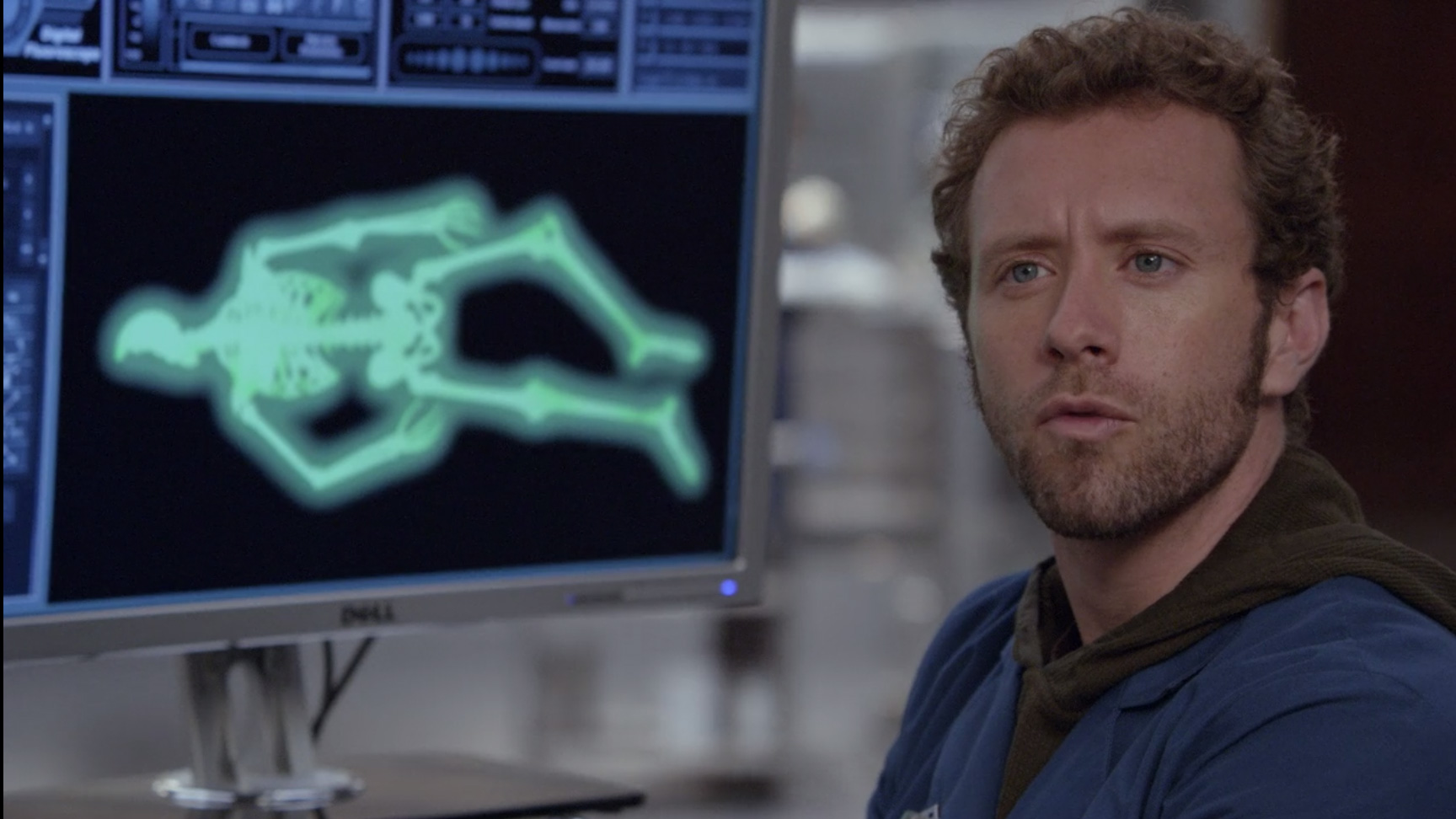 Dr. Jack Hodgins