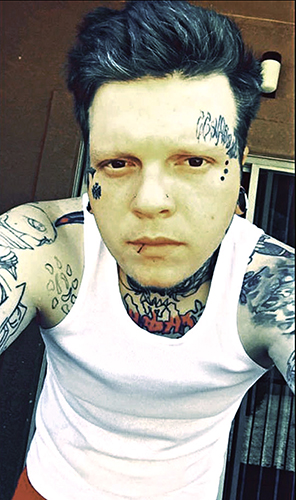 Anthony Ewald